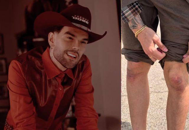 Luan Pereira mostra joelhos machucados após pagar promessa em Fátima